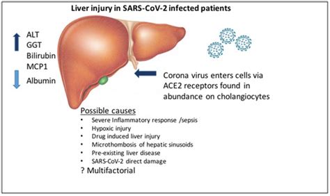 SARS-CoV-2 Infection and the Liver