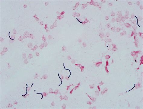 How to read your blood culture report – MyPathologyReport