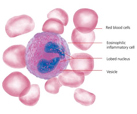 Absolute Eosinophils Parasites at Carolyn Huddleston blog
