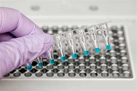 Image result for Paternity Testing Procedure