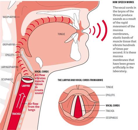 Vocal cord dysfunction definition, triggers, causes, symptoms ...