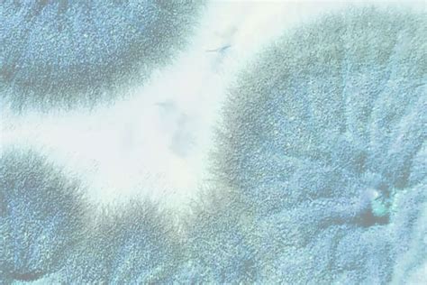 Can Chlamydia Be Dormant? | Evvy