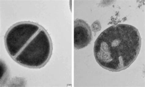 Study Finds Human Protein Recycling System Acts as Natural Antibiotic ...