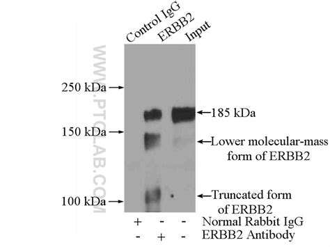 HER2/ErbB2 antibody (18299-1-AP) | Proteintech