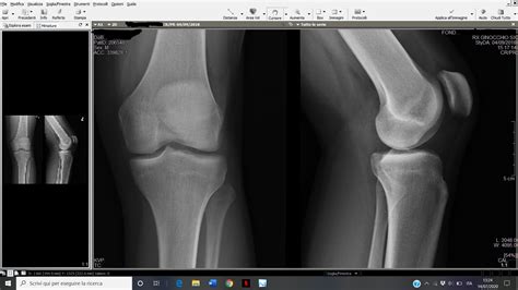 Image result for Appendix with Screen Shot Example