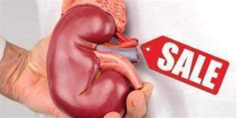 Karnataka transport bus conductor puts kidney on sale to meet financial ...