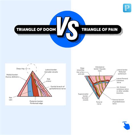 Triangle Of Doom And Pain