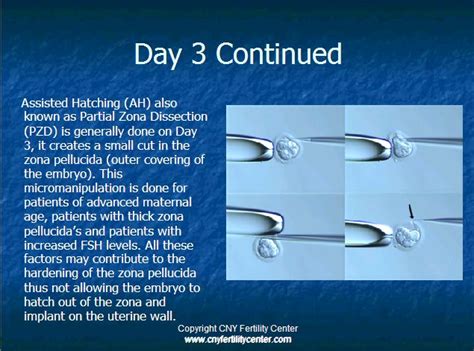 Image result for Early Embryo Development