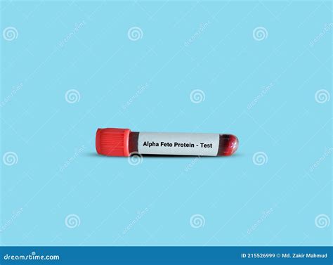 Test Tube with Blood Sample for AFP Alfa-fetoprotein Test. Stock Image - Image of carcinoma ...