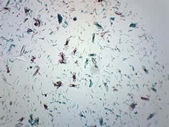 10PK Mixed Diatoms, Wholemount - Prepared Microscope Slides - Classroom ...