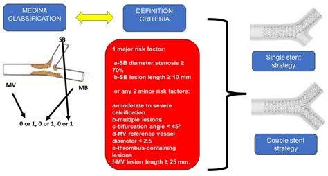 Basics of Coronary Bifurcation and Treatment in Brief | Encyclopedia MDPI