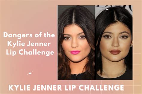 The Dangers of the Kylie Jenner Lip Challenge