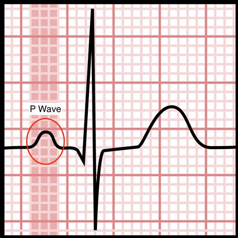 O Que Significa A Onda P No Ecg - RETOEDU