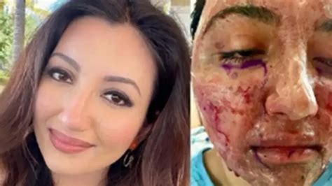 Indian-American Miss World 2021 First Runner-Up Lives With Pacemaker ...