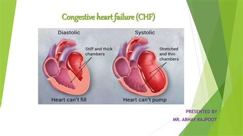 Congestive heart failure | PPTX