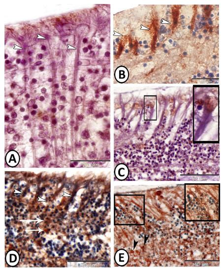 Ependymal and Neural Stem Cells of Adult Molly Fish (Poecilia sphenops ...