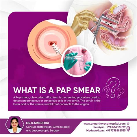 How a Pap smear by Dr. George Papanicolaou can save your health | DR ...