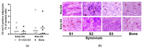 Synovium-Derived and Bone-Derived Mesenchymal Stem/Stromal Cells from ...
