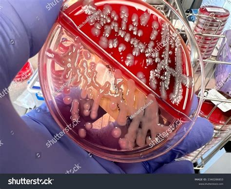 Klebsiella Pneumoniae On Blood Agar