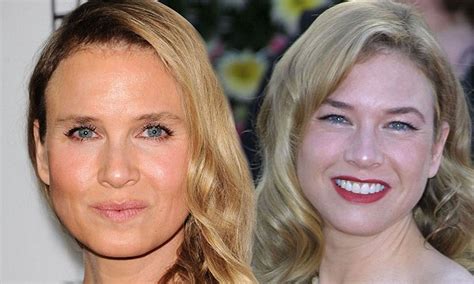 Cosmetic surgery new look renee zellweger now 323998-Renee zellweger cosmetic surgery