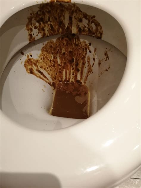 Exploding Poop Human 的图像结果