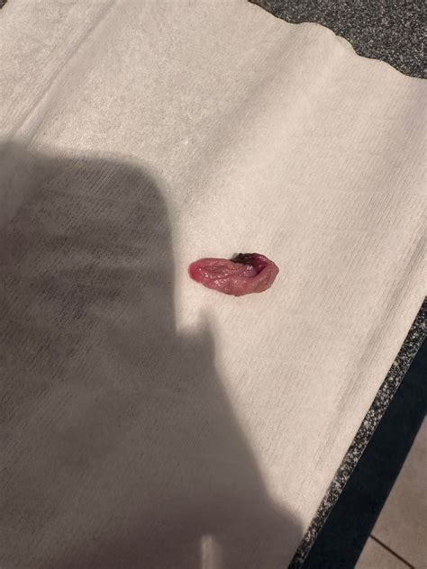 BLOOD CLOT, MISCARRIAGE, OR DECIDUAL CAST?? : r/Periods