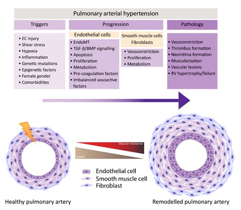 Endothelial Dysfunction in Pulmonary Hypertension: Cause or Consequence?