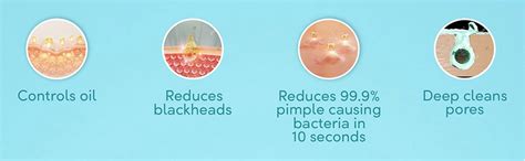 Pond's Pimple Clear Face Wash 100 gm | With Active Thymo T Essence ...