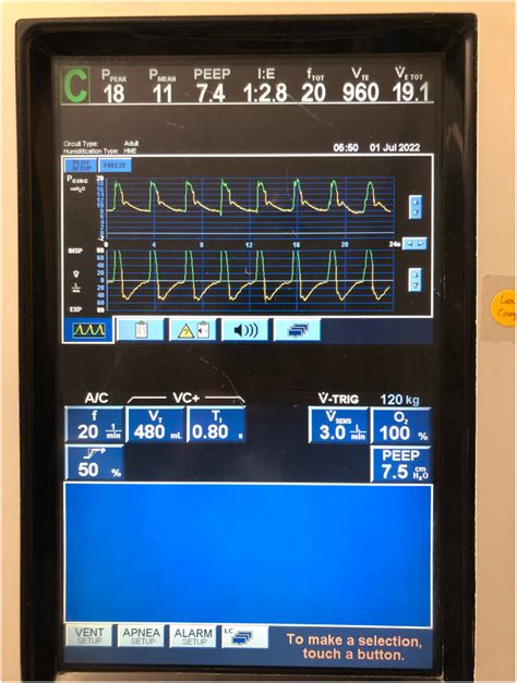 Image result for Normal Pressure Control Settings