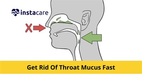 How Can You Get Rid Of Throat Mucus Fast?
