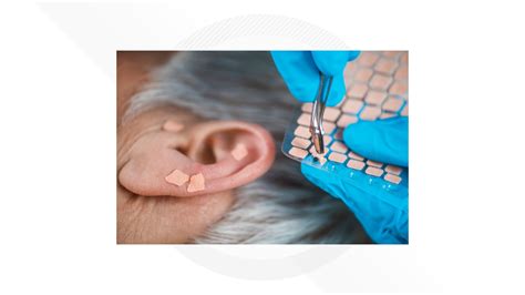 What is ear seeding? | wzzm13.com