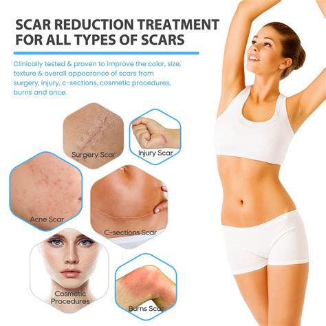 Cosmetic Surgery Scar Treatment