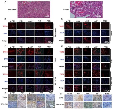LncRNA RP11-79H23.3 Functions as a Competing Endogenous RNA to Regulate ...
