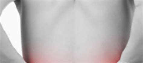 Bulging Disc Example 的图像结果