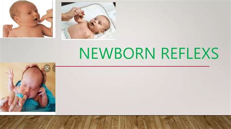 Newborn Reflex 的图像结果