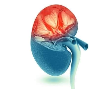 أخصائي بولية