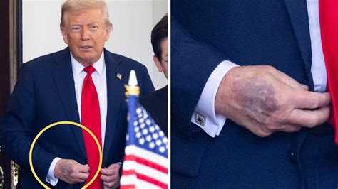 White House Physician Reveals All Details Regarding President Trump’s Health After Visit To The Hospital