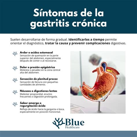 Gastritis crónica: causas, síntomas, diagnóstico y tratamiento
