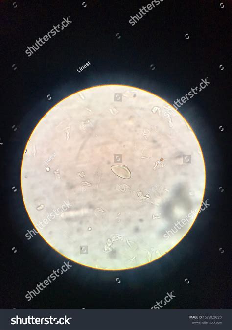 Pinworm Egg