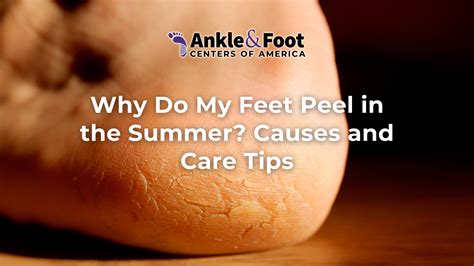 Why Does My Heel Hurt? A Foot Doctor Explains the Causes
