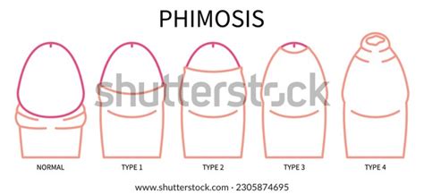 Image result for Simbol Lab API