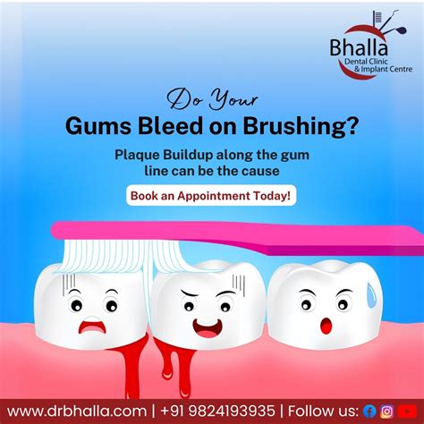 Bhalla Dental Clinic - Dr. Manjit Singh Bhall | 🪥 Do your gums bleed while brushing? 🩸 Bleeding ...