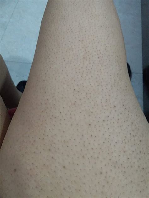 IS THIS NORMAL AFTER WAXING?? : r/Skincare_Addiction
