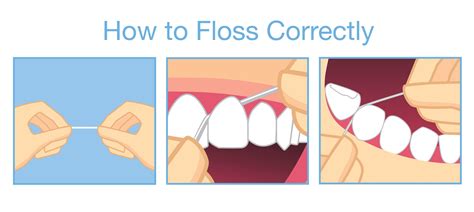 Flossing Tips: The Ultimate Guide to a Healthier Smile - Twin Smiles Orthodontics