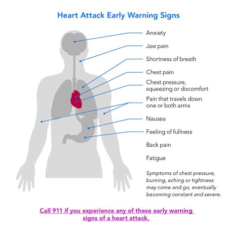 Heart Attack Pain Location