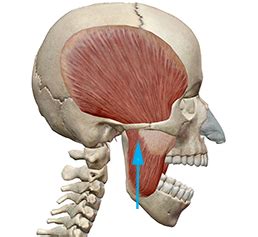Image result for Masseter Muscle Trigger Point