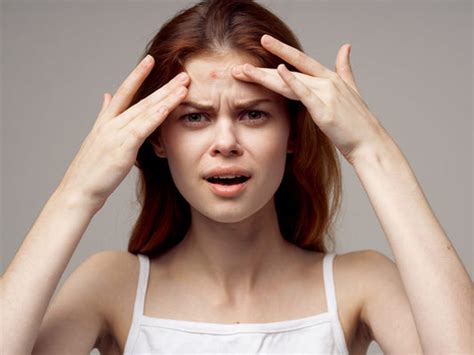 Pimples On Your Forehead? Get Rid Of Them With These Remedies! – SkinKraft