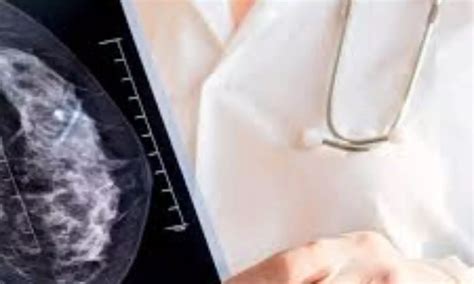 Ultrasound alone effective for diagnosing noncalcified masses recalled ...