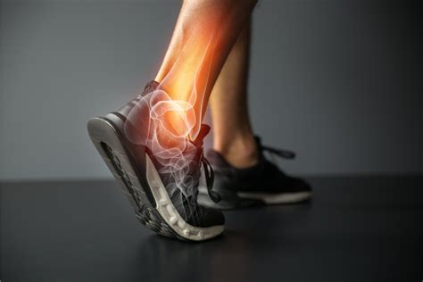 Ankle Sprains - aka Acute Lateral Ankle Sprains/Ruptures | Studio ...
