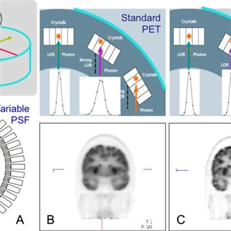 Image result for Spatial Resolution Pet